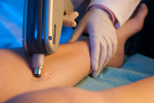 Foto laserterapia